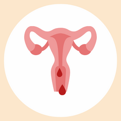 Retrograde Menstruation