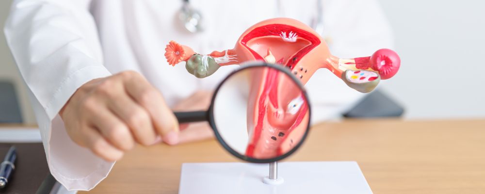 What are the Types of Endometriosis?