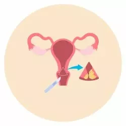 Biopsy of Endometrial Tissue​