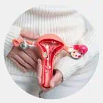 Endometriosis