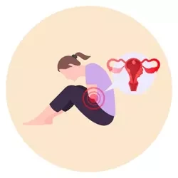 Endometriosis