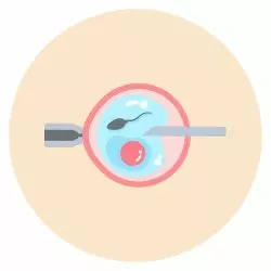 IVF-ICSI failures