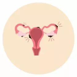 Treatment of Uterine Abnormalities