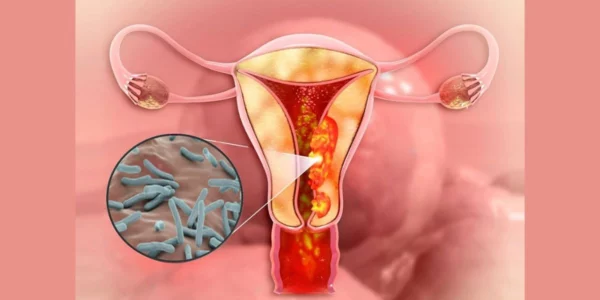 Understanding the Impact of Female Genital Tuberculosis