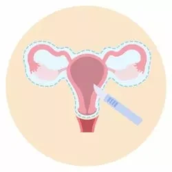 Uterine Fibroids​