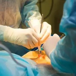 laparoscopy