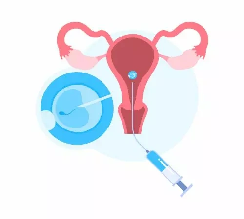 previous ivf failures